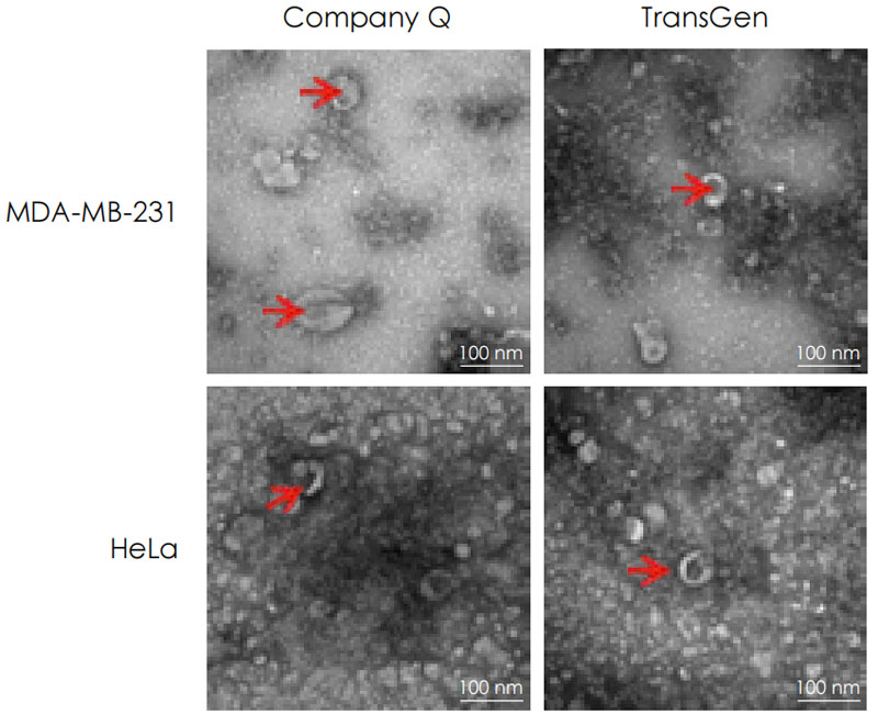 電鏡檢測 電鏡檢測