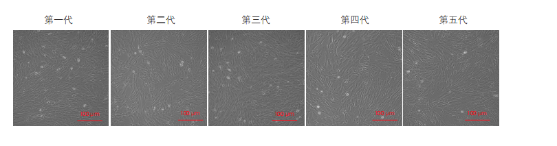 間充質干細胞培養(yǎng)圖 間充質干細胞培養(yǎng)圖